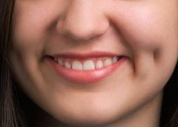 Ternyata Ini Fakta di Balik Lesung Pipi yang Mempesona