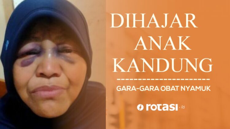 Ibu Ini Babak Belur Dihajar Anak Kandung Gara-gara Obat Nyamuk